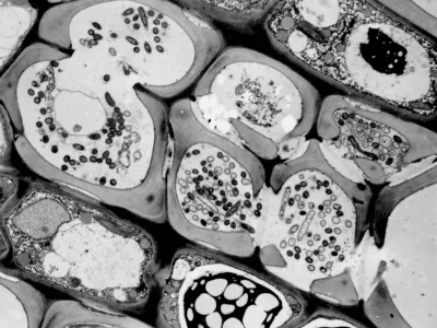 Xylella fastidiosa in xylem vessels of plum